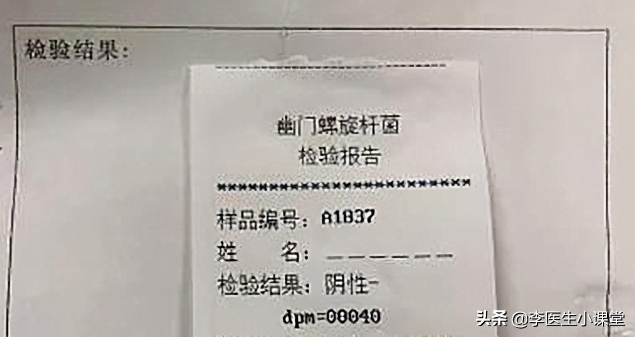 透视盘点 第135页